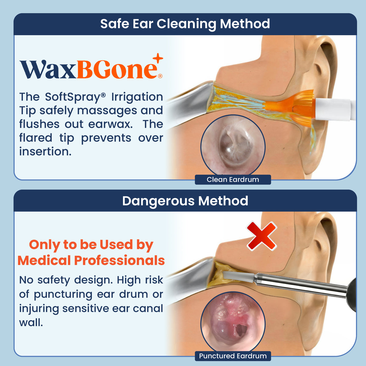 Premium Earwax Removal Kit
